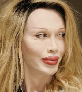Pete Burns