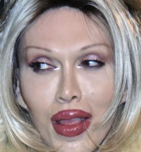 Pete Burns