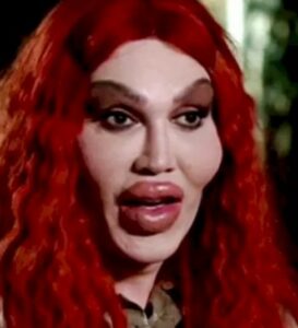 Pete Burns