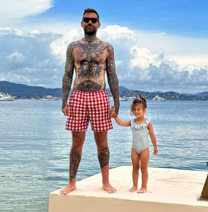 Is Adam22 Bald? Discovering the Facts About His Hair Transplant